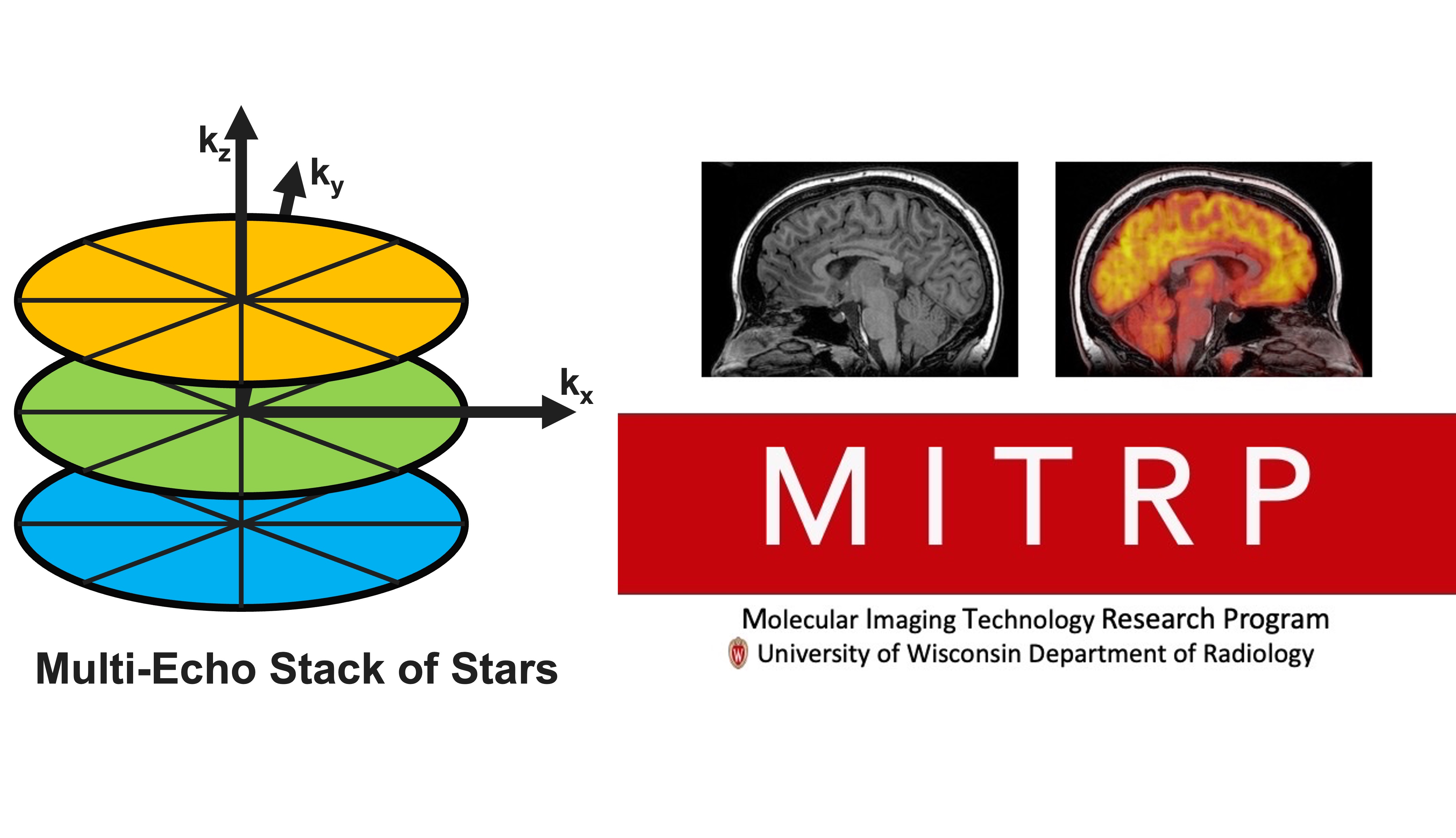 Multi-Echo Stack of Stars Logo